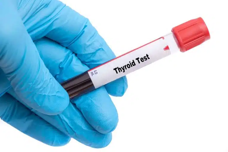 Total Thyroid Profile